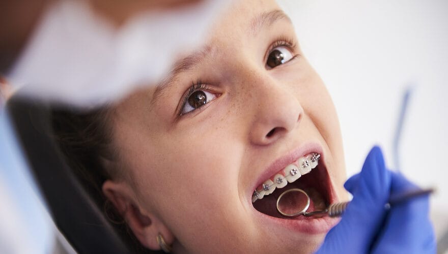 ortodonti tedavisi ile dis teli uygulamasi yapan dis hekimi