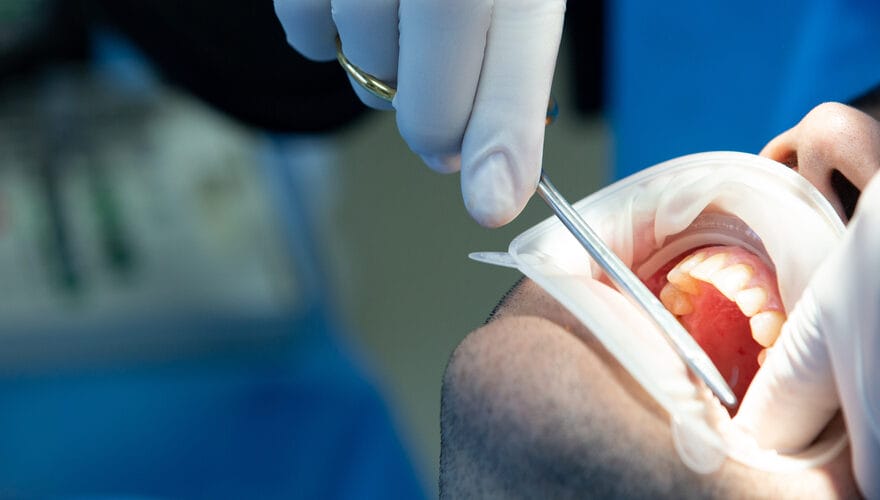 dis ve cene cerrahisi kapsaminda yapilan cerrahi mudahale islemi