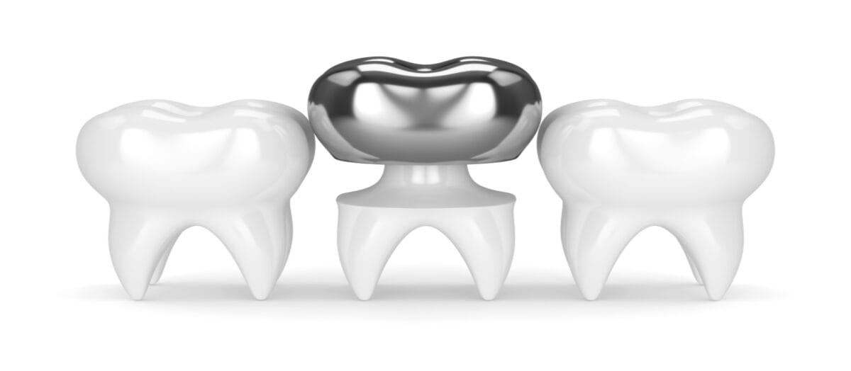 Paslanmaz Çelik Kuron