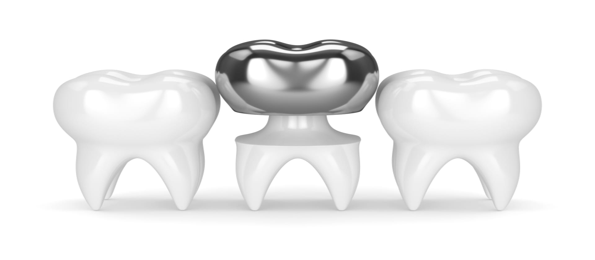 sut dislerine uygulanan paslanmaz celik kron gorunumu