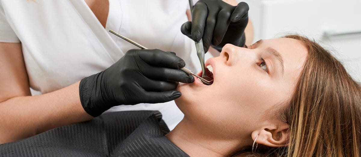 Diş Dolgusu Nedir? Nasıl Yapılır, Acıtır mı?