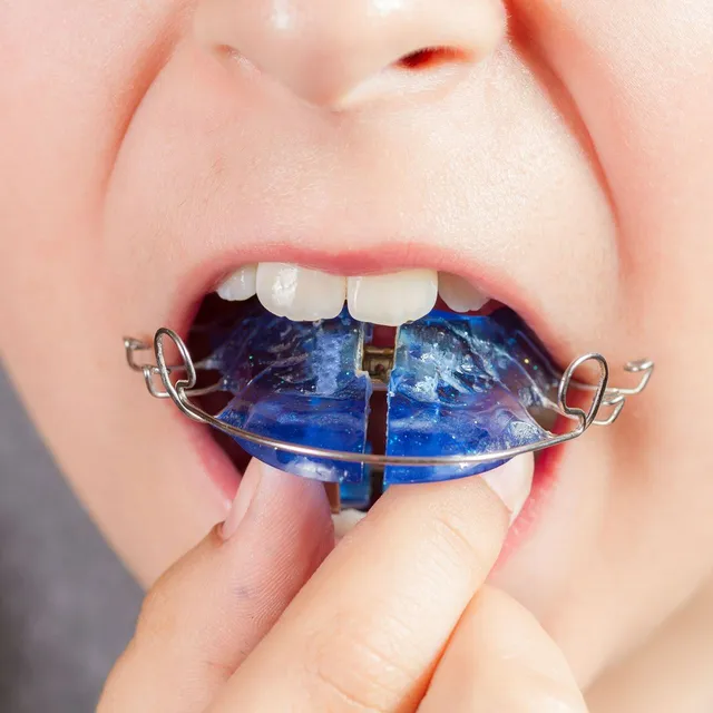 cocuklarda aparey tedavisi icin kullanilan damaklik