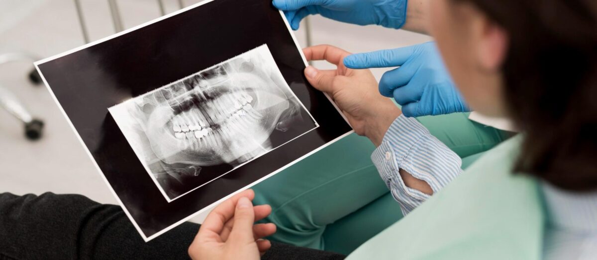 İmplant Cerrahisinde Tomografi Neden Önemli? | Eryaman Diş Hekimi