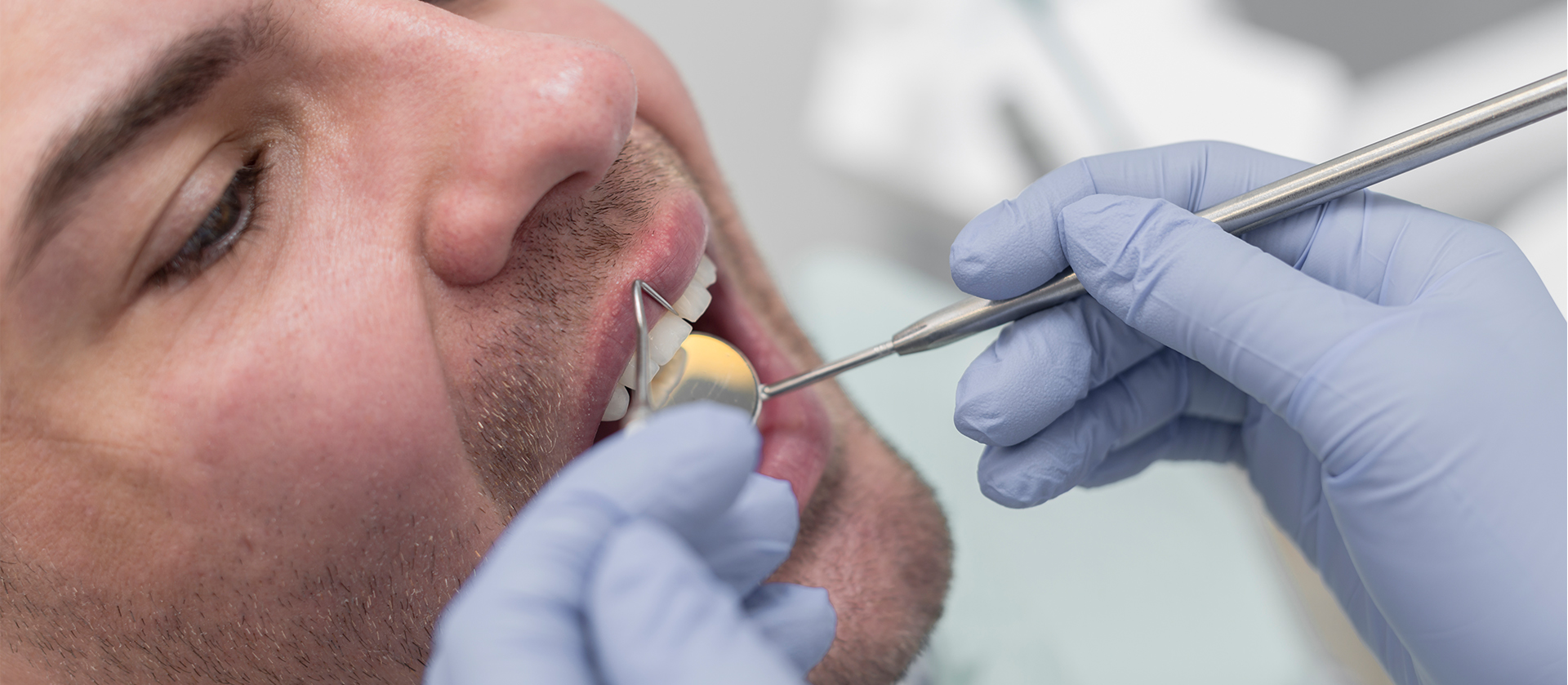 inley onley endokron nedir diş tedavisi uygulaması